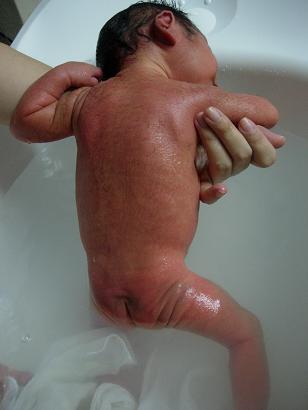 毛深い 新生児 赤ちゃんが毛深いときに知っておきたい胎毛・産毛こと